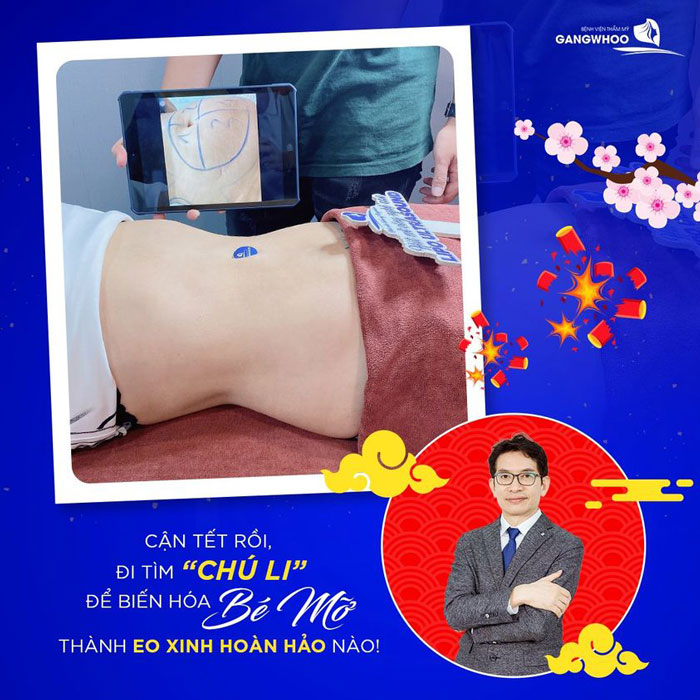 Hút Mỡ Bắp Tay Chẳng Ngại Ngần Thả Dáng Năm 2023