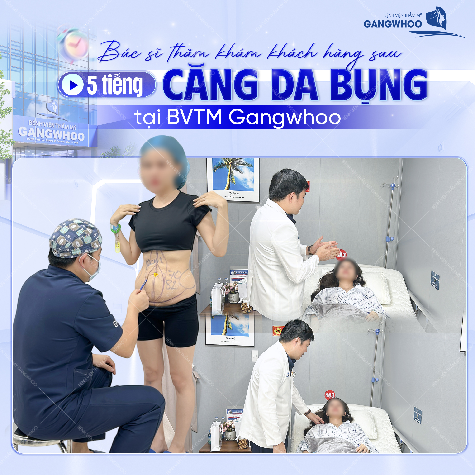 Bên canh dịch vụ hút mỡ tại Gangwhoo còn căng da bụng khắc phục tình trạng da trùng nhão cho khách hàng