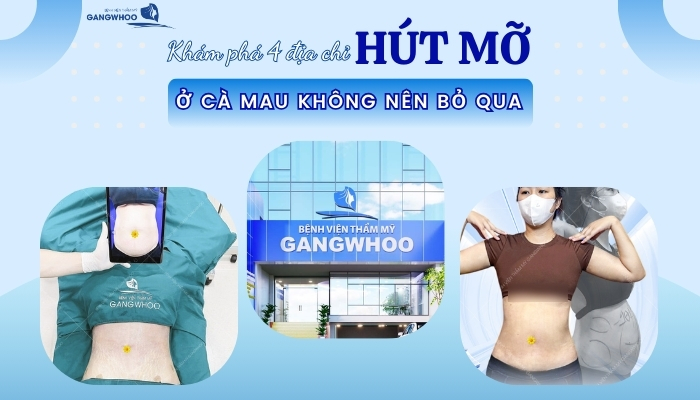 Khám Phá 4 Địa Chỉ Hút Mỡ Ở Cà Mau Không Nên Bỏ Qua