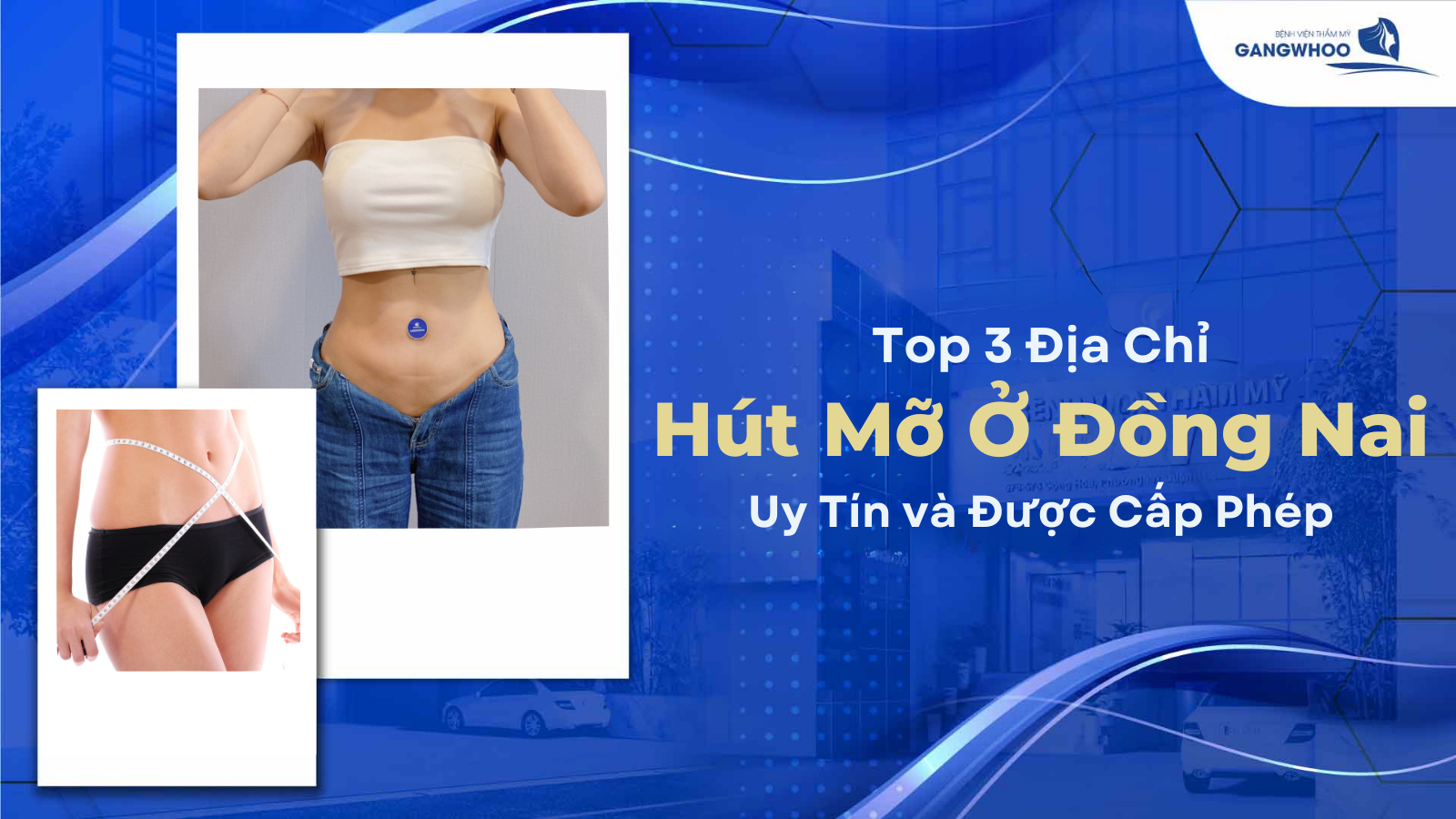 Top 3 địa chỉ hút mỡ ở Đồng Nai uy tín và được cấp phép