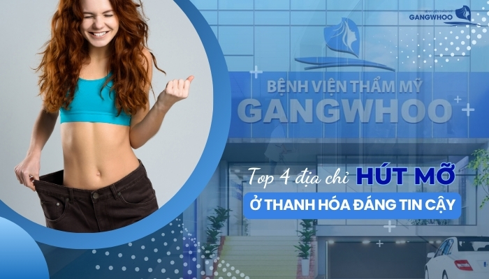 Top 4 Địa Chỉ Hút Mỡ Ở Thanh Hóa Đáng Tin Cậy