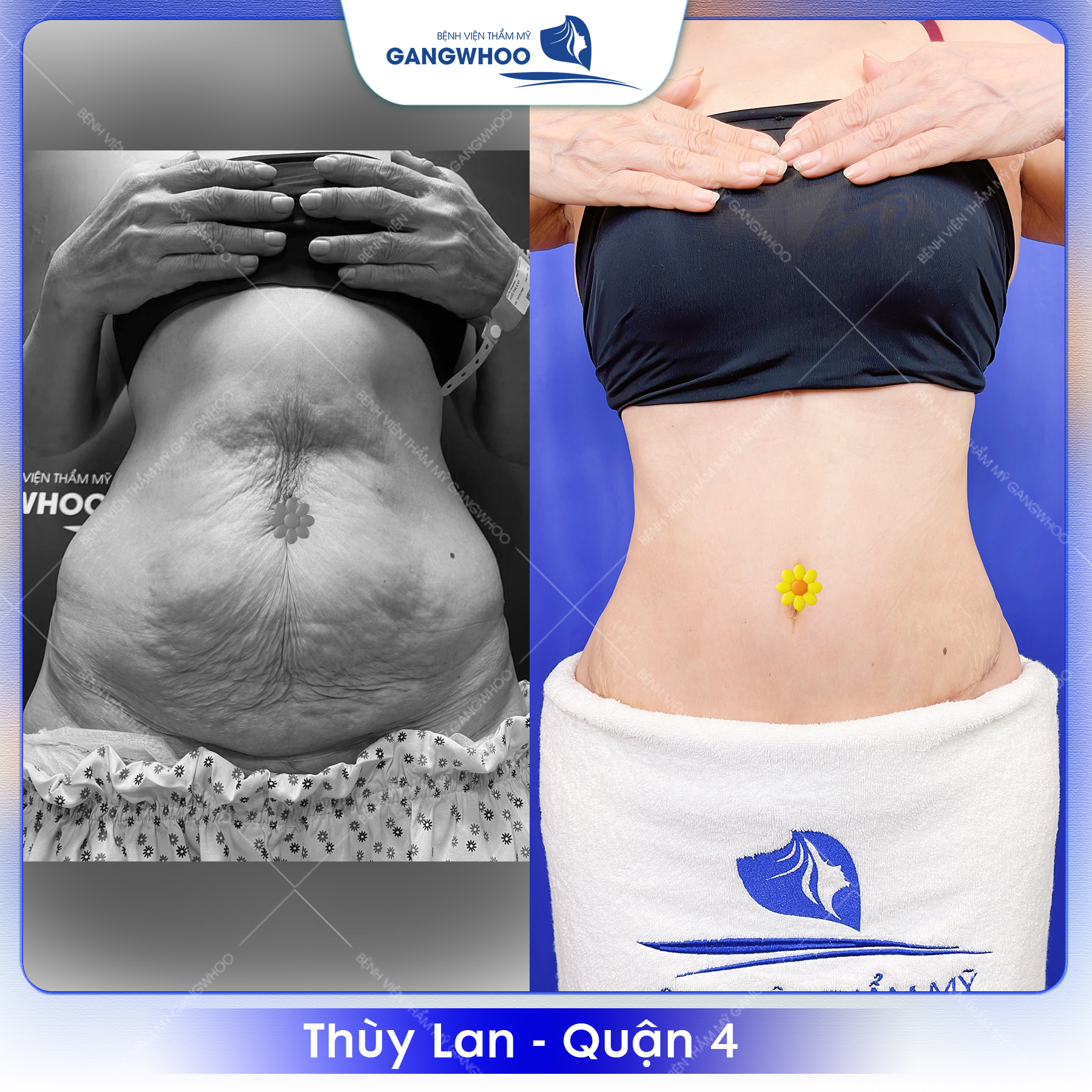 Nếu bạn muôn sở hữu vòng eo đẹp hãy đến ngay BVTM Gangwhoo