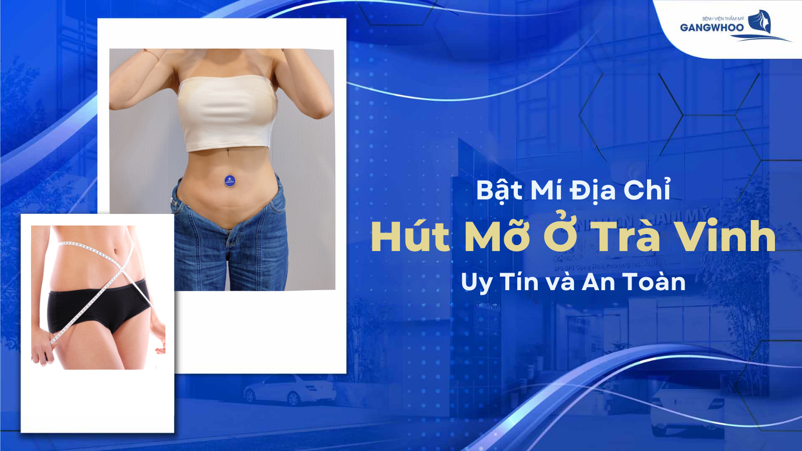 Bật mí địa chỉ hút mỡ ở Trà Vinh